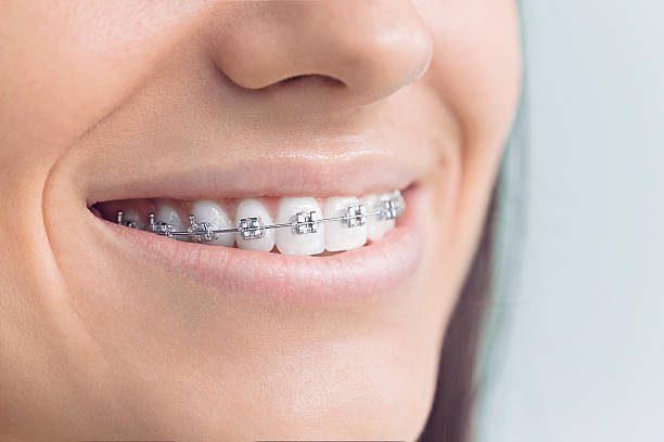Why Choose Us for Your Dental Needs in Wellsville, UT